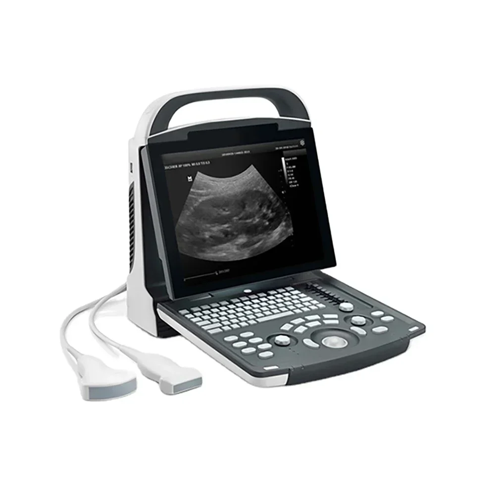 Mindray Dp 10 Portable Ultrasound Machine Price