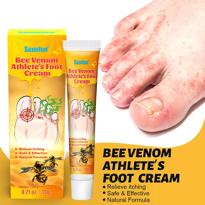 1pcs 20g Foot Care Cream Herbal Cream Foot Tinea Pedis Treatment Cream Treat Beriberi Ointment Anti-itch Inhibits Fungus Peeling