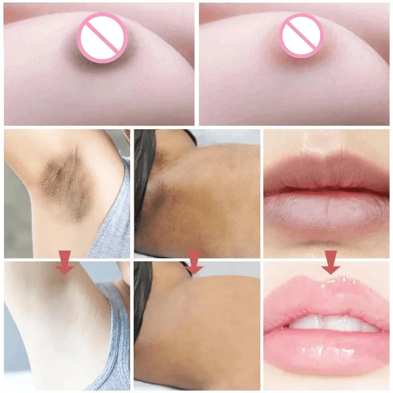 Female nipples labia private powdery whitening cream to lighten the inner thigh private dark remove melanin body whitening