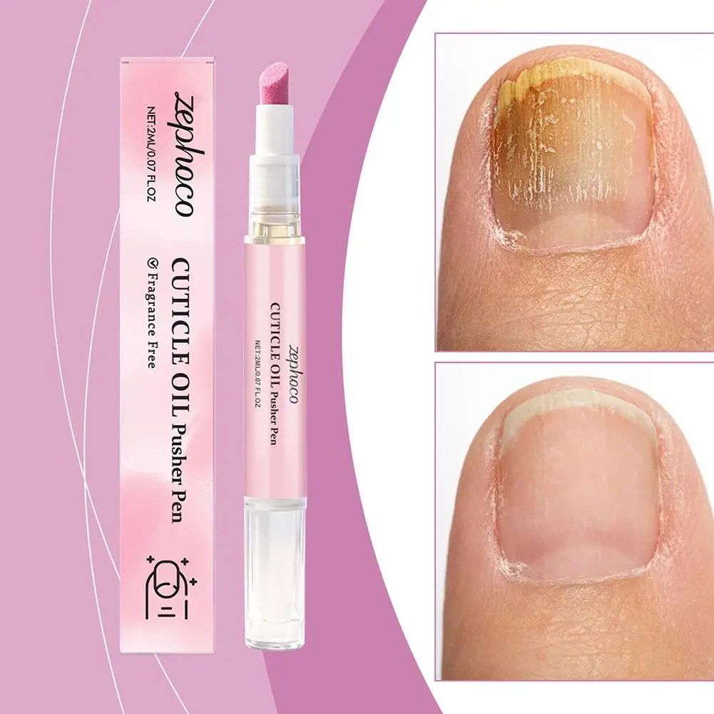 Nail Cuticle Oil Pen Barrier Protection Moisturizing Treatment Oil Fine Brush Nourish Nail Surface Prevent Dry Cracked Skin