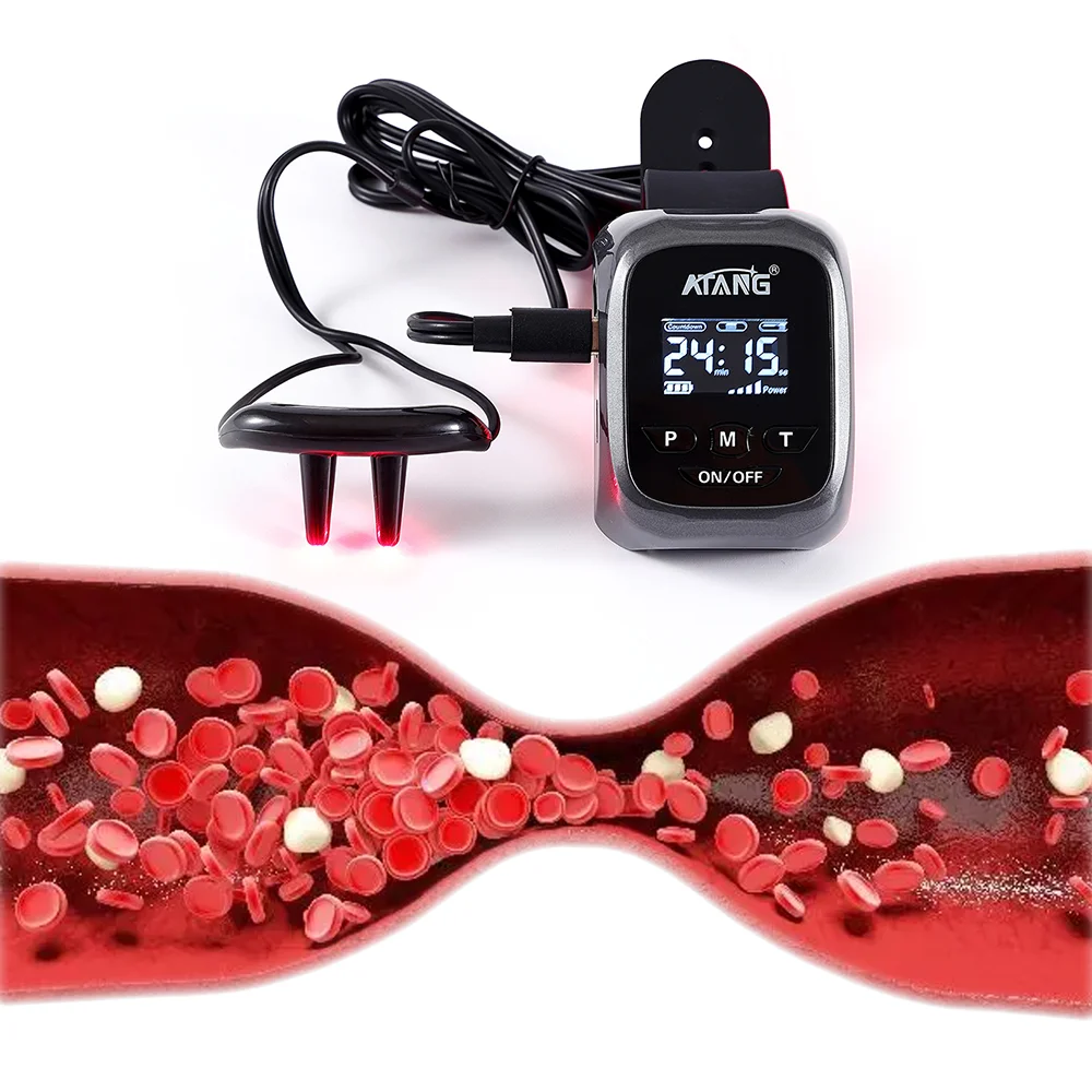 Blood Viscosity Laser Watch for High Blood Pressure Rhinitis Cholesterol Hypertension Low Level Laser Therapy