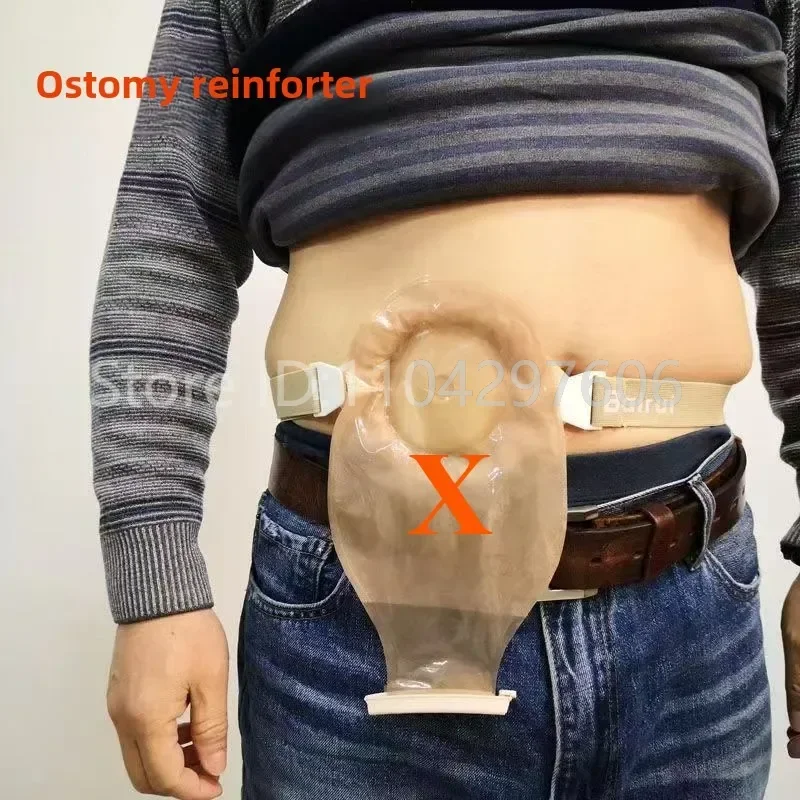 1m Portable Adjustable Ostomy Hernia Belt Stoma Abdominal Belt, Colostomy Ileostomy Urostomy Reinforcement Nursing Accessorie