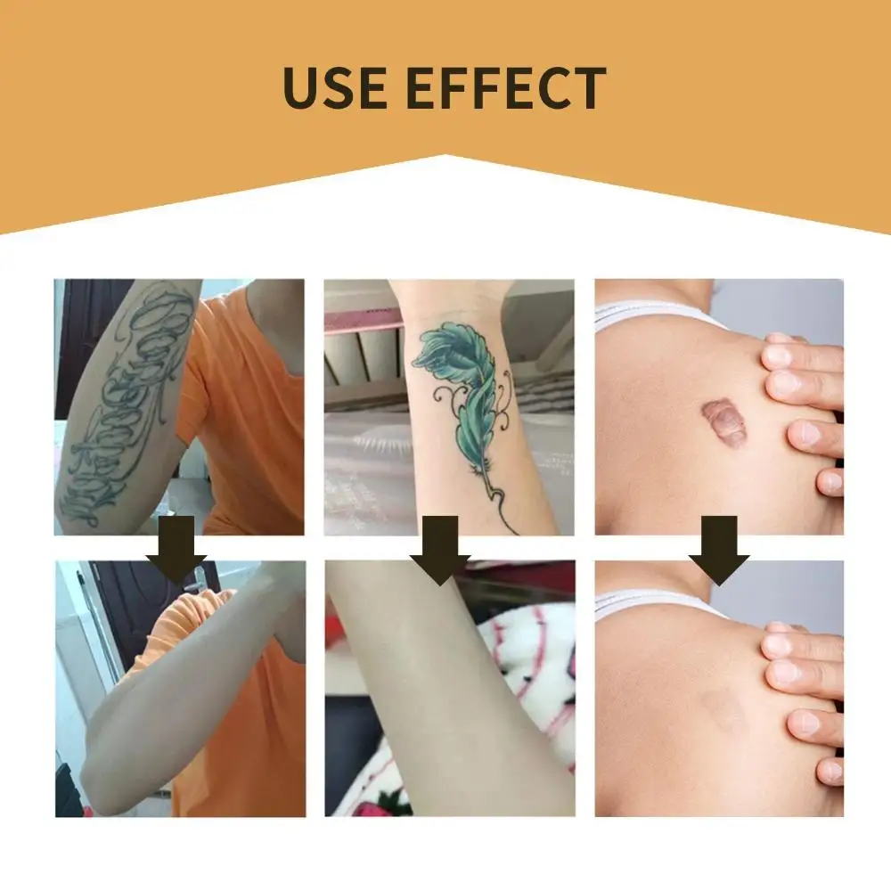 Repair Scar Blemish Sticker Invisible Breathable Concealer Patches Skin Sticker Scar Acne Cover Up Tattoo Sticker