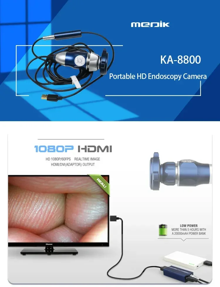 مصنع توريد جهاز طبي عالي الدقة معدات جراحة فيديو بالمنظار منظار داخلي عالي الدقة محمول