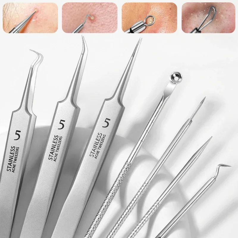 German Ultra-fine No. 5 Cell Pimples Blackhead Clip Tweezers Beauty Face Health Salon Special Blackhead Remover Acne Needle Tool