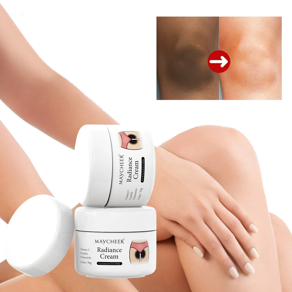 50 جرام كريم تبييض أجزاء خاصة تحت الإبط تبييض تبييض بعقب الركبة سطع الفخذ الداخلي الأجزاء الحميمة إزالة الميلانين الداكن #6