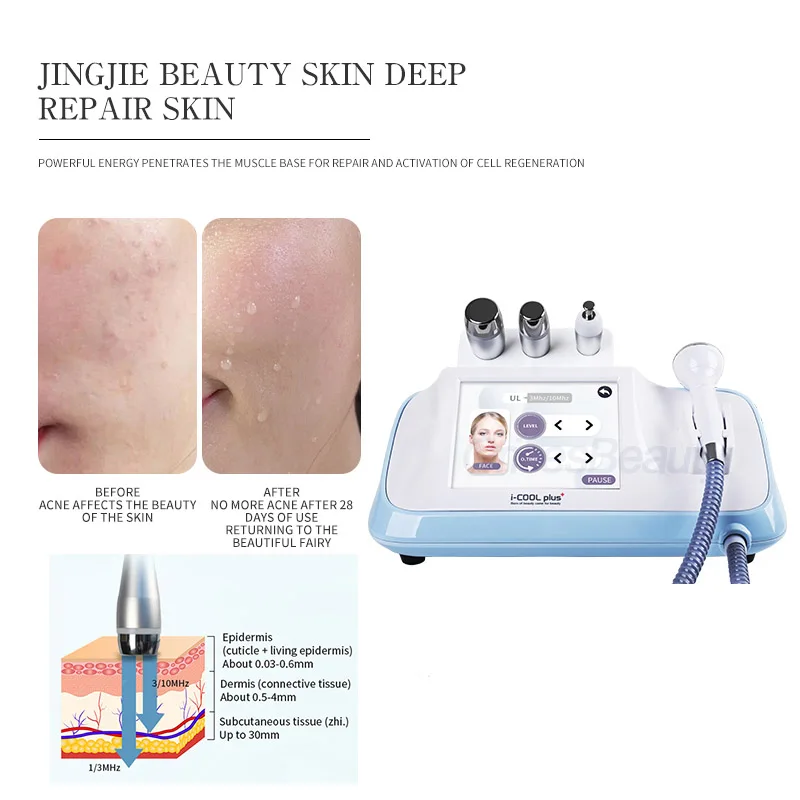 

Бестселлер 2026 года: Лучший аппарат для омоложения и подтяжки кожи лица, увлажняющий прибор для лифтинга лица с эффектом водной мгновенной подтяжки