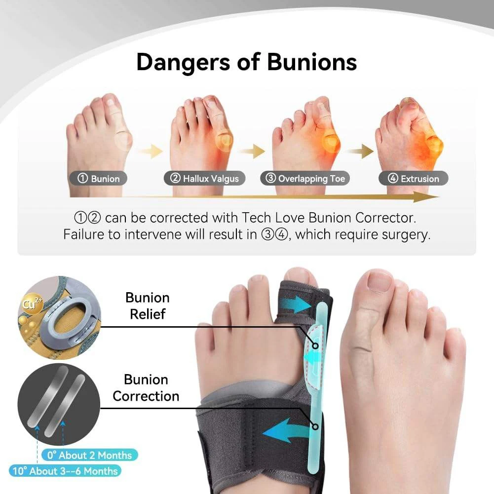 SplendocBig Parker Straightener Spacer, Bunion Ration Tors, Hallux Valgus oto, Instituts Protection, Non-ald, 1 paire