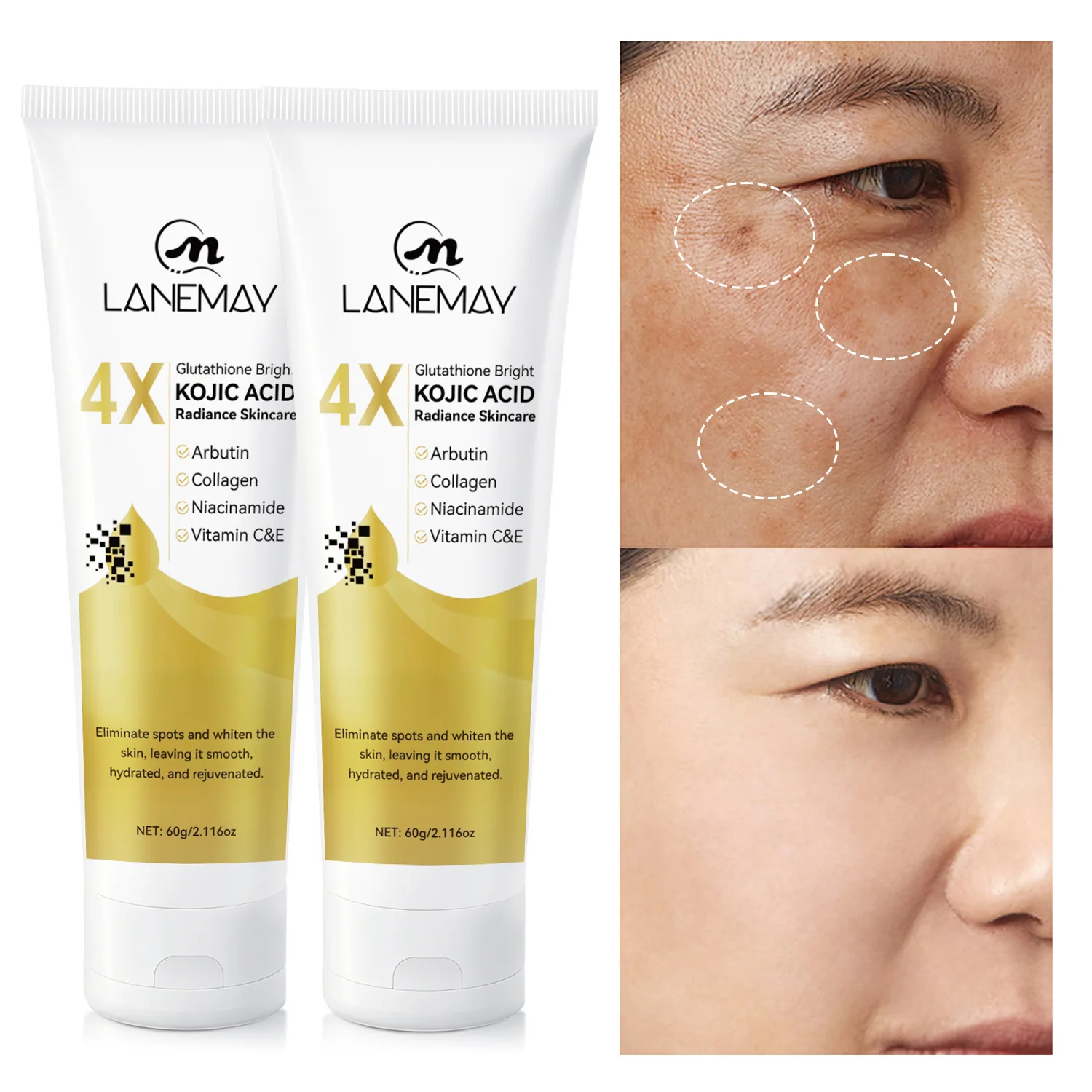4X Glutathione Bright Kojic Acid Radiance Skincare - Elimina las manchas, unifica el tono, suaviza e hidrata, 60 g