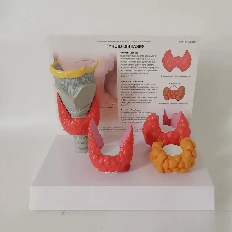 High Simulation Human Thyroid Disease Model Anatomy Teaching Props Medical School Display Aid for Doctor Nurse Student