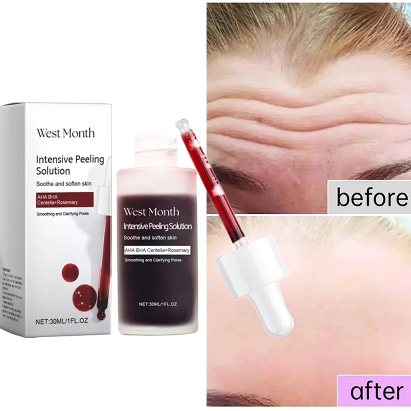 

Fruit Acid AHA BHA Serum Anti Acne Exfoliating Repairing Fade Fine Lines Shrink Pores Moisturizing Salicylic Acid Face Skincare