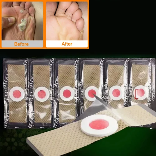 48 Uds pegatina para el cuidado de los pies parche médico almohadillas de eliminación de maíz parches curativos callos eliminar callosidad desintoxicación parche para el cuidado de los pies de verano