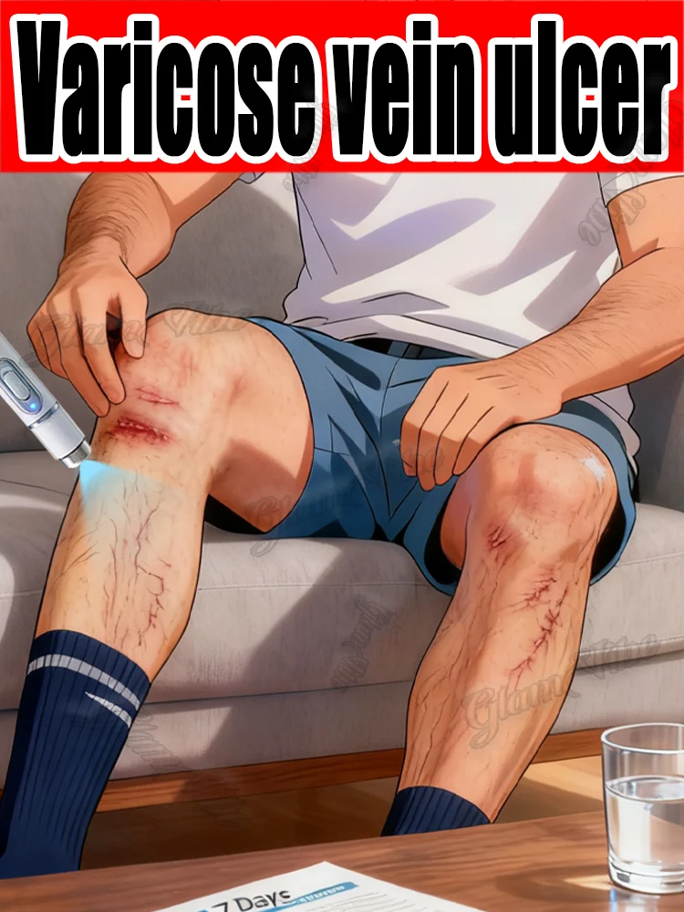 

Лазерная ручка для лечения вен второго поколения, можно использовать для лечения варикозного расширения вен.