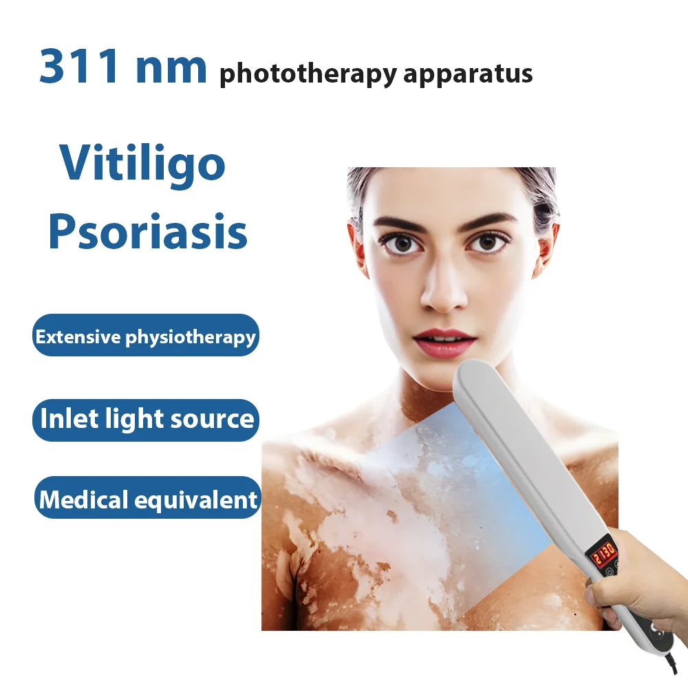 

311 nm uvb lamp vitiligo treatment cure narrow band vitiligo treatment uvb lamp