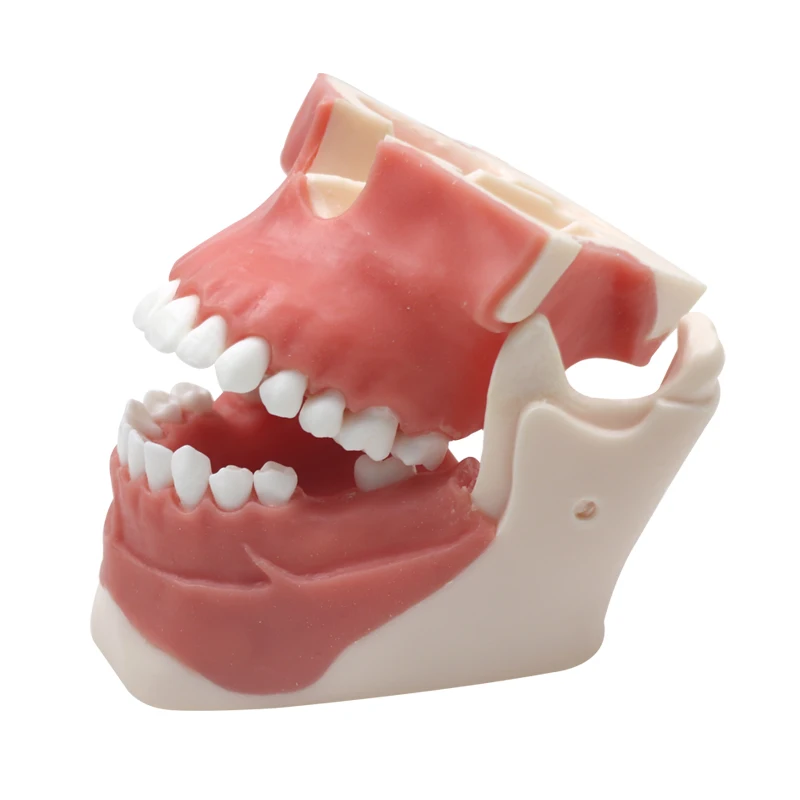 Medical Implant Teeth Model Removeable Teeth Dentist Practice Training Studying Model Dentist Tools