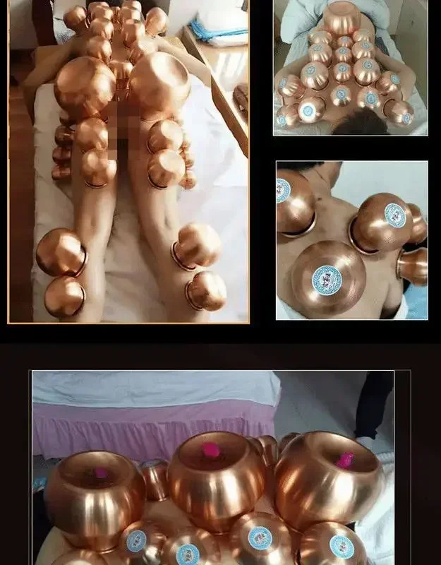 جديد كوب نحاسي الصينية فراغ الحجامة عدة سحب جهاز فراغ العلاج الاسترخاء مدلك منحنى مضخة شفط 6 قطعة