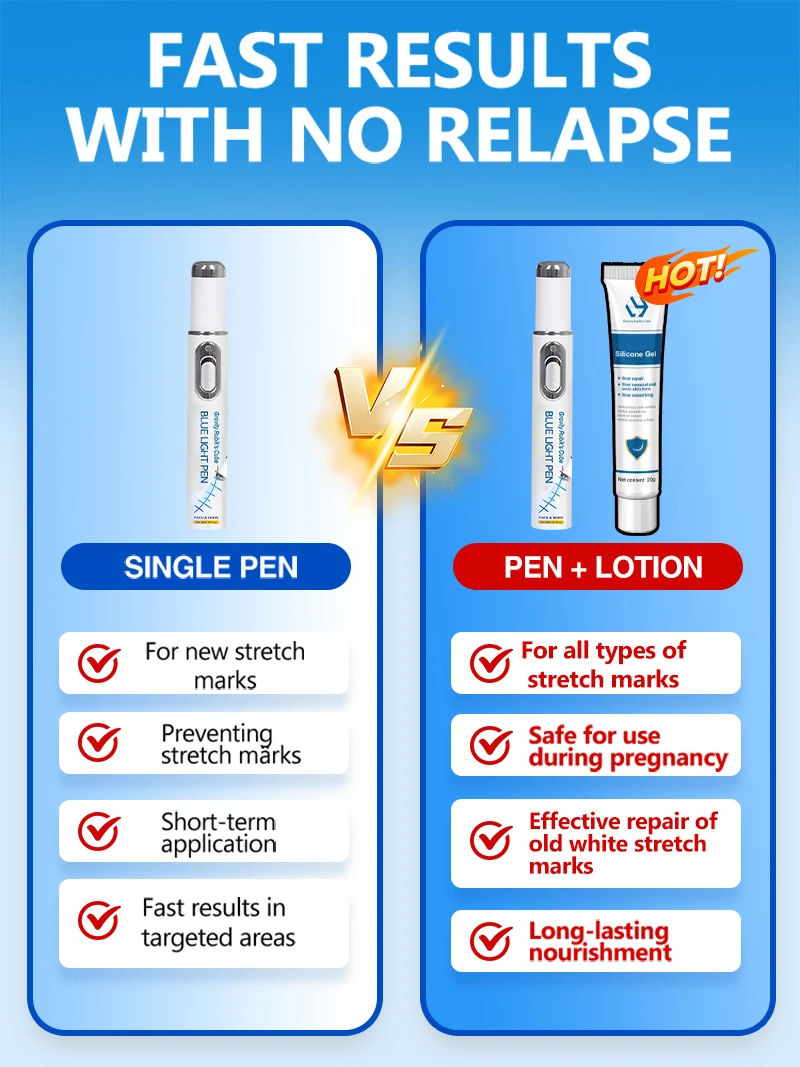 Striae Blue Light-apparaat Elimineert lichaamsstriae Producten Gereedschappen