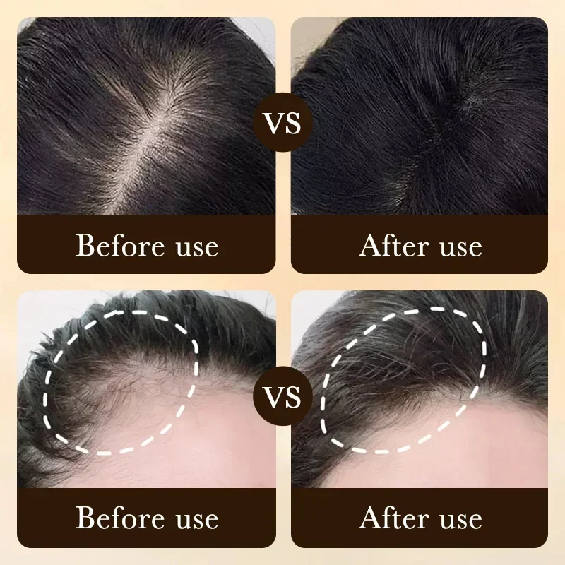 Biotin Fast Hair Growth Oil Products Care Scalp Massage Treatments Anti Hair Loss Effective Grow Thicker Hair Serum Men Women