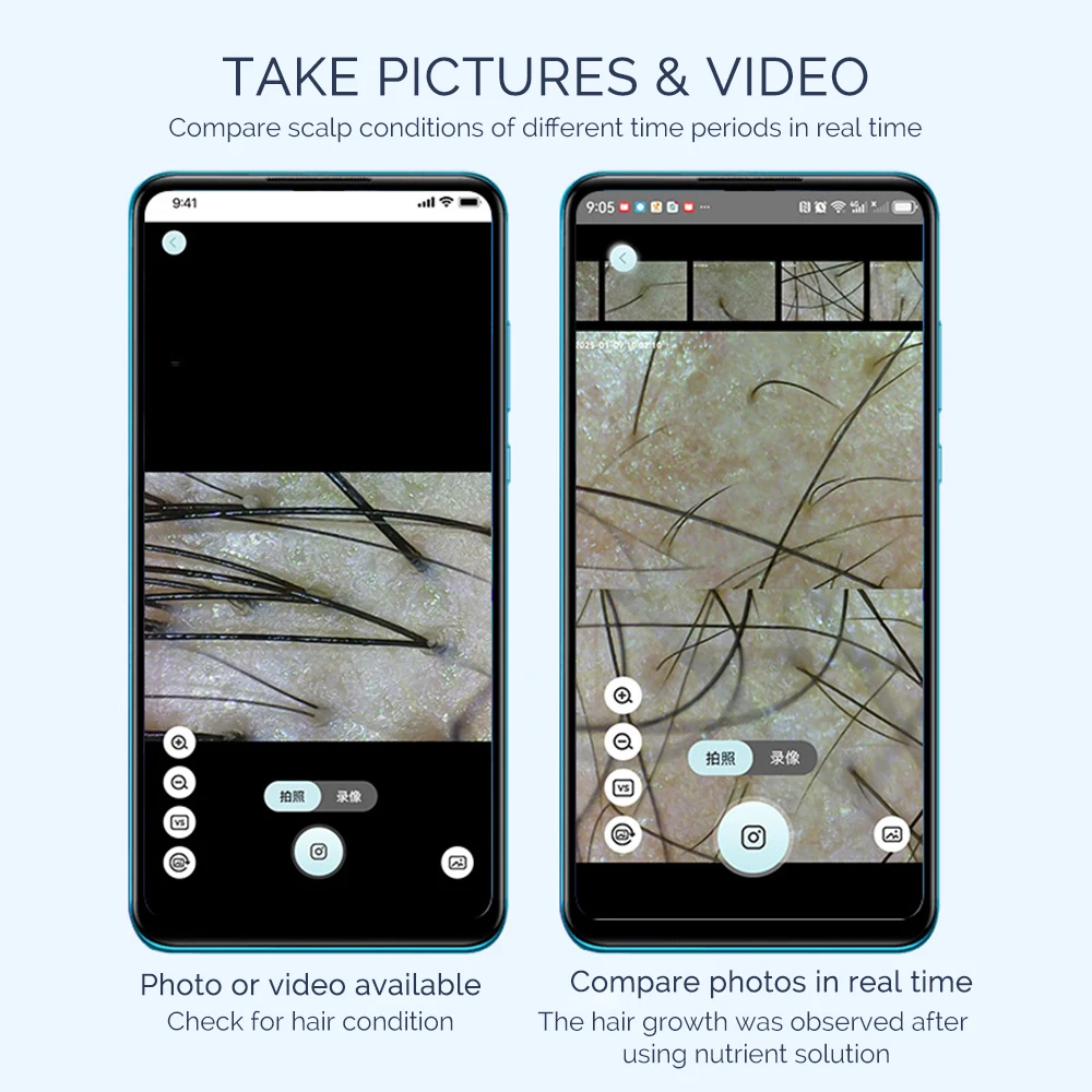 新しい 50X/200X 毛包頭皮検出器皮膚鏡テスター皮膚分析機頭皮診断スキンケアツール