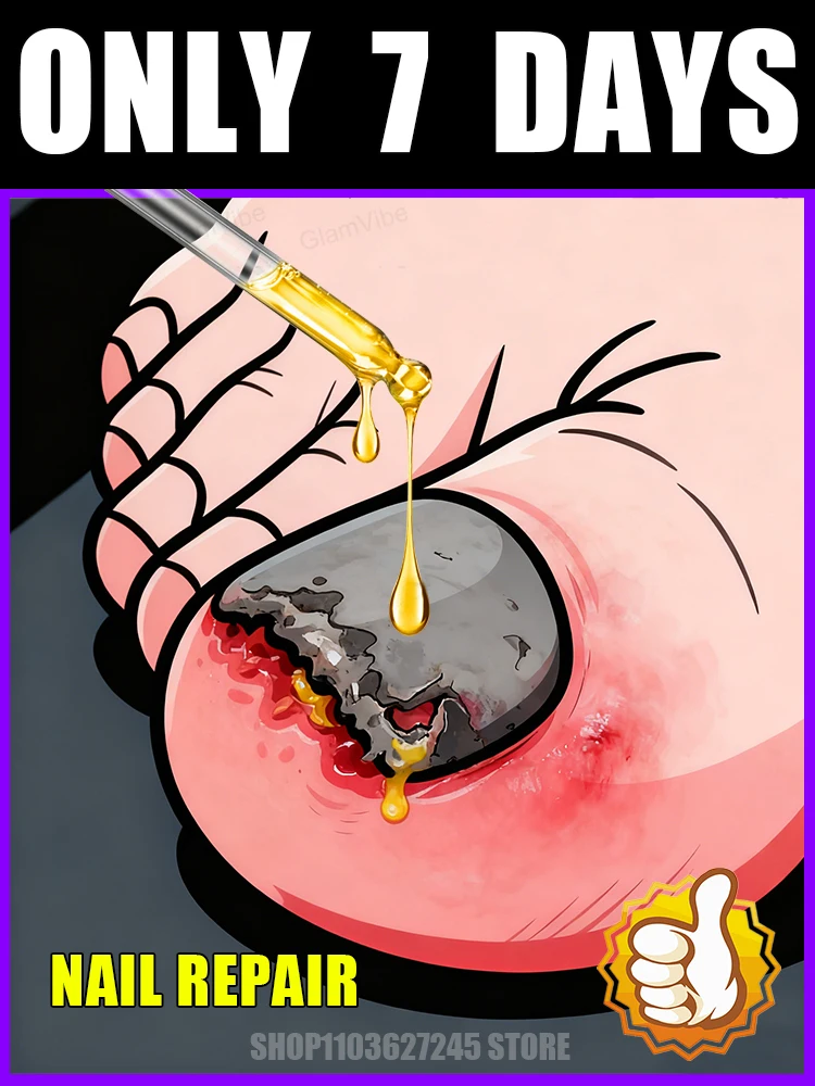 

Fast penetration, nails become translucent and fungal free.