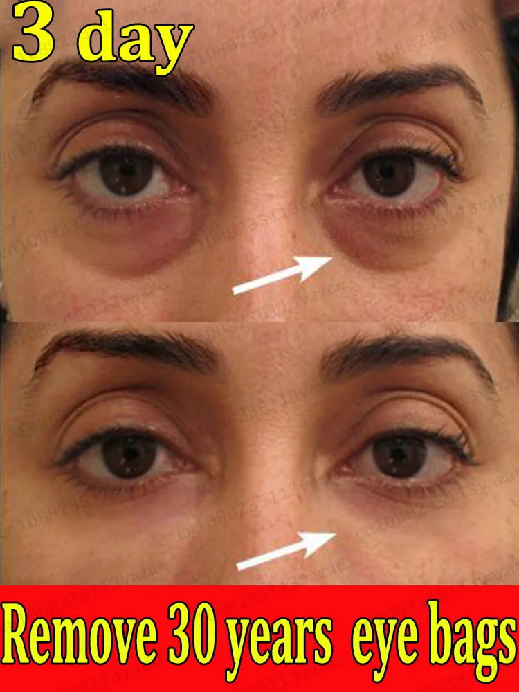 

сделай вас 20-летним младшим