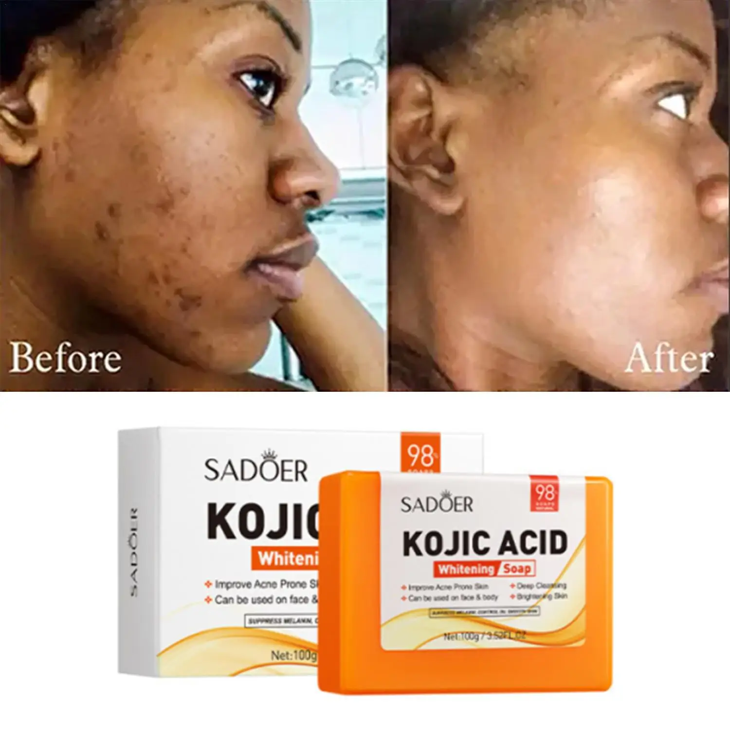 SADOER Kojic Acid Facial Soap Face Wash Foam Facial Cleanser Moisturizing Hydrating Oil Control Body Bathing Handmade Soap