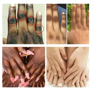 كريم كوجيك حمض التغذية السريعة ، كريم اليدين باهت التلاشي ، تفتيح الأسود ، تفتيح ، مرطب ، العناية بالبشرة الكورية أفضل 10 مبيعات لتفتيح البشرة الكورية - رقم 3