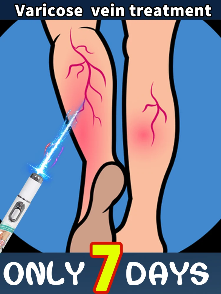 

Mini laser pen, your right choice.