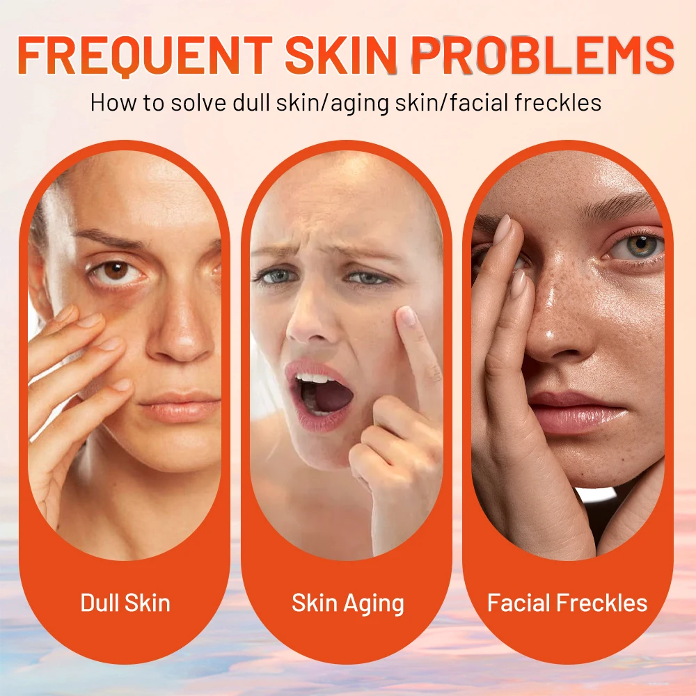 كريم مرطب للوجه ، علاج حب الشباب ، إزالة البقع الداكنة ، تبييض ، بشرة مشرقة ، رفع ، ثبات ، عناية