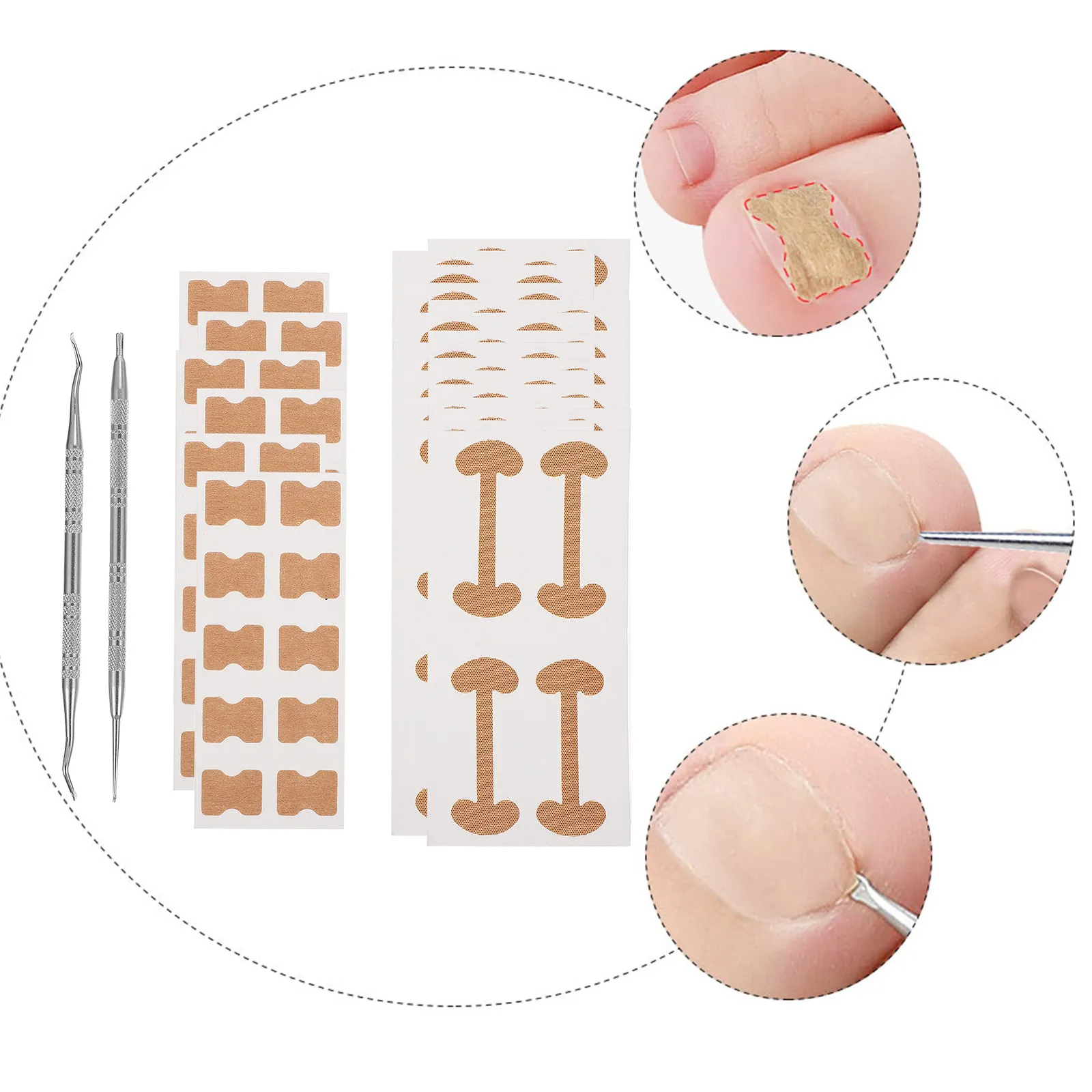 

1Set Toenail Corrector Stickers Premium Ingrown Toenail Relief Tool for Curved Nail Repair Fast-Acting Orthopaedic Patches