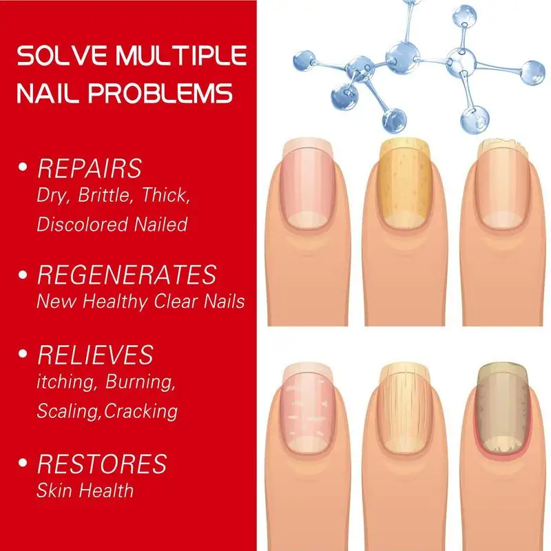 Nail Growth Oil Nail Repair Liquid For Growth Portable Nail Cuticle Conditioner Nail Strengthener Mild Nail Cuticle Oil For