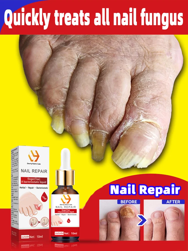 

Oil Products For Solving Nail Problems