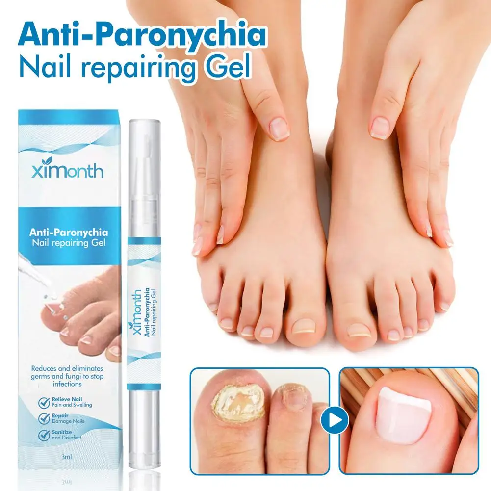 Caneta indolor do reparo do prego, Serum do reparo das unhas dos pés, Anti cuidado para mais grosso quebrado, N9F7 descolorido