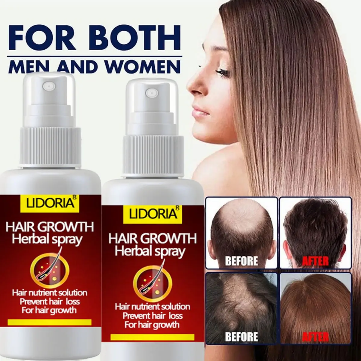 Hair Growth Serum Spray Fast Hair Growth Liquid Treatment Scalp Hair Follicle Anti Hair Loss Natural Beauty Health Hair Care