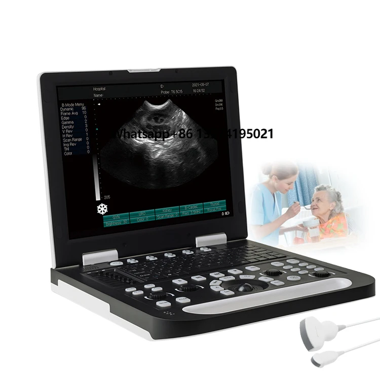 Ruisheng N50 Vet 3d 4d Color Ultrasound with 2 Probe Sockets 15 Inch Screen Ecografo Veterinarian