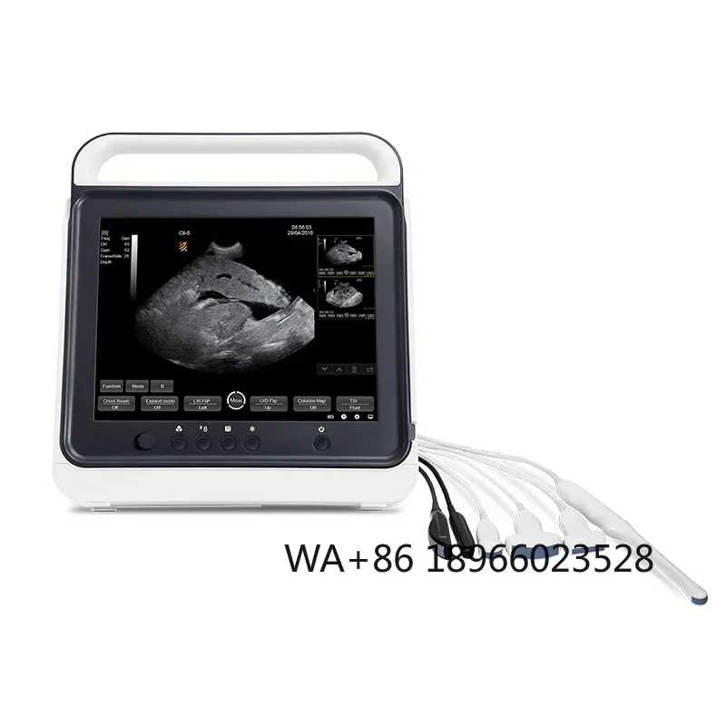 Veterinary Touch Screen Portable Ultrasound Scanner,black & White Ultrasound Machine Price