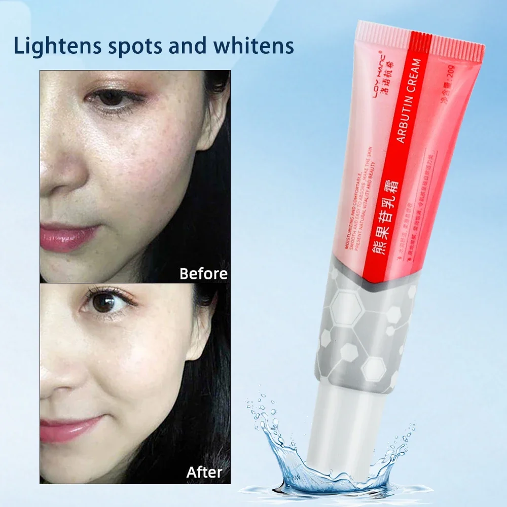 Freckle Whitening Cream Anti Aging Remove Wrinkles Nourishing Moisturizing Facial Cream Brightening Anti-Wrinkle Face Skin Care