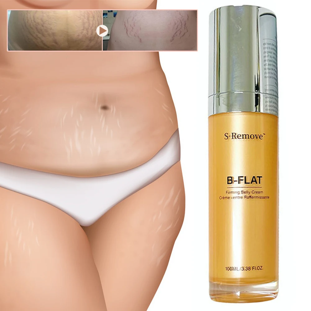 Stretch Marks Removal Cream For Stomach Skin Tightening Body Cream Achieve A Confident Beach Body