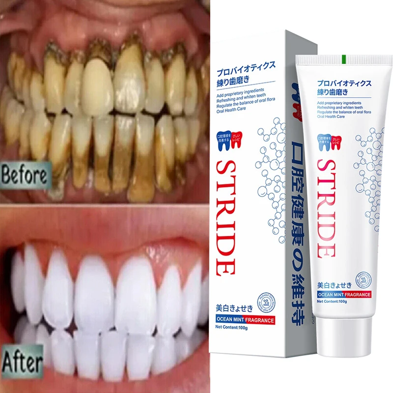 Dental Calculus plaque Remover Bad Breath Removal Whitening Teeth Toothpaste Brightening Preventing Periodontitis Cleansing Care