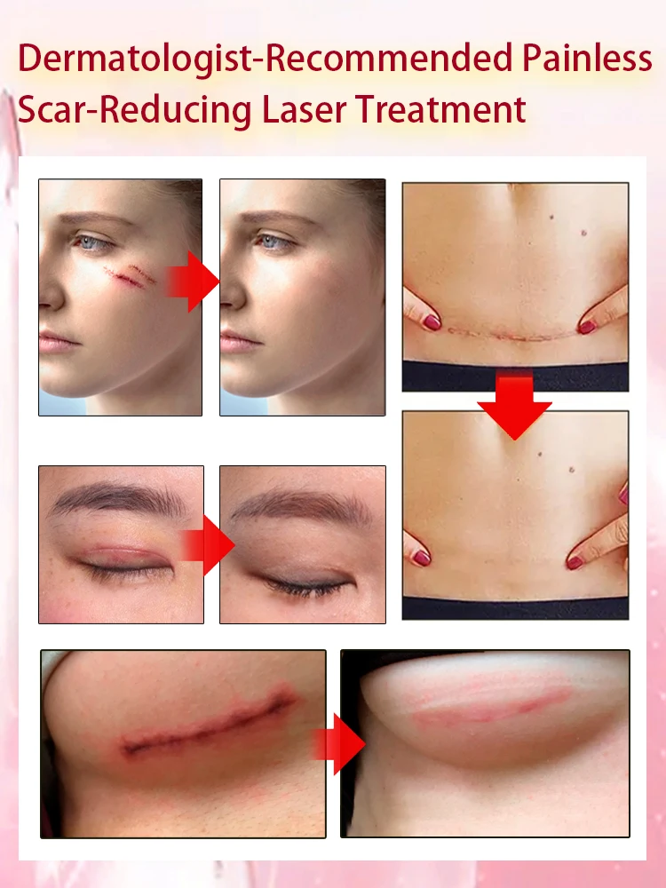 Scar problems various scar repair