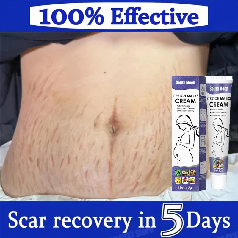 

Stretch Mark Repair Cream For Pregnant Women Postpartum Care Firm Light Lines Obesity Lines Growth Lines Repair Cream New