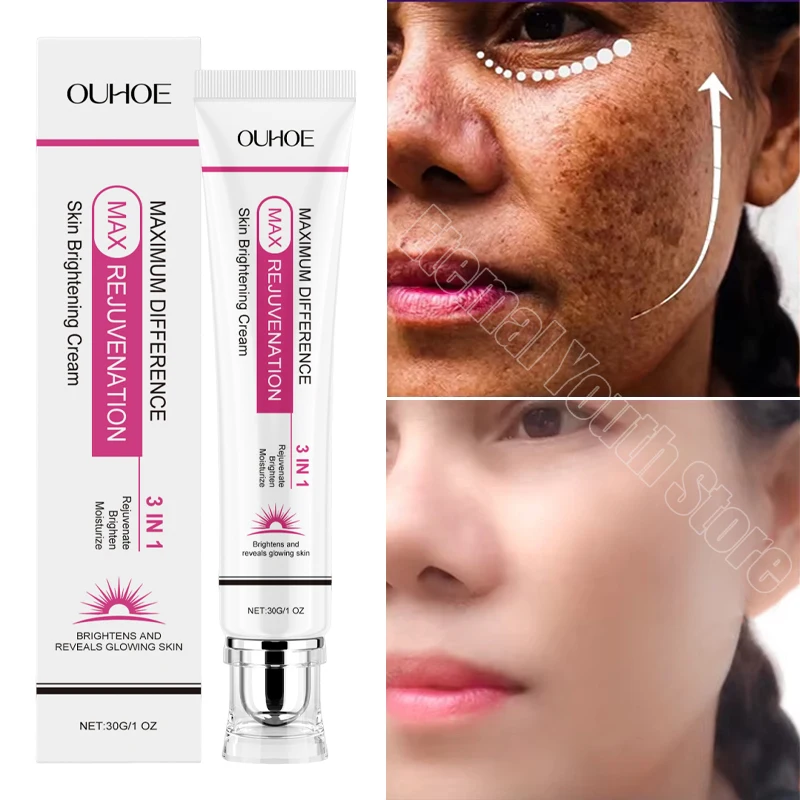 

Powerful Spot-removing Whiten Cream Brighten Skin Fast Eliminates Melanin Pigmentation Melasma Dark Spots Korean Skin Care