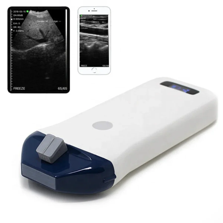 Wifi Probe Type 10-14MHz L25 Wireless High Frequency Color Doppler Ultrasound