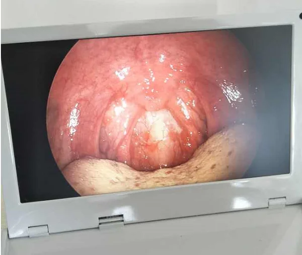 Professinal Surgical Portable Arthroscopy System