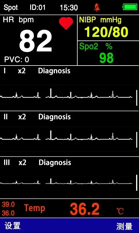 2025 PC200 Handheld Mobile Portable Wireless Monitor Multiparameter Vet Monitor de Sign Vital with ECG function