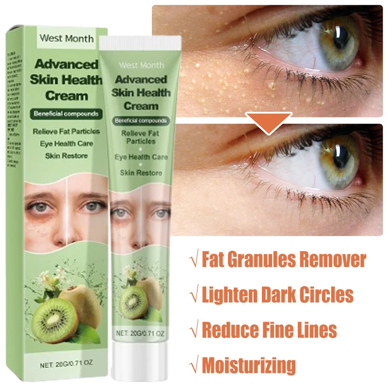 

Fat Granules Remover Eye Cream Anti-Puffiness Anti Inflammatory Reduce Dark Circles Fade Fine Lines Repair Barrier Firm Cream