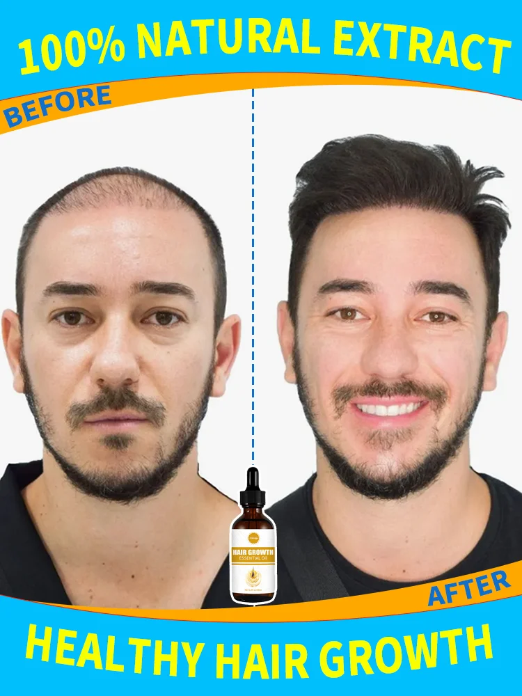 

little brown bottle.hair growth essential 0iI. Say goodbye to baIdness. The secret 0f thick hair hair growth serums