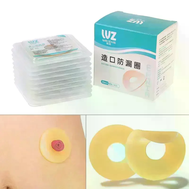 /Kuz/Baseplates Stoma Care Products To Protect Skin Anti-Leakage Ring For Colostomy Bag Ostomy Paste Ring 10Pcs