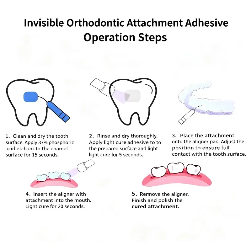 Westlake Bar Light Cure Enamel Bonding Resin Invisible Orthodontic Attachment Adhesive Dental Consumables Clinic Dentist Supply