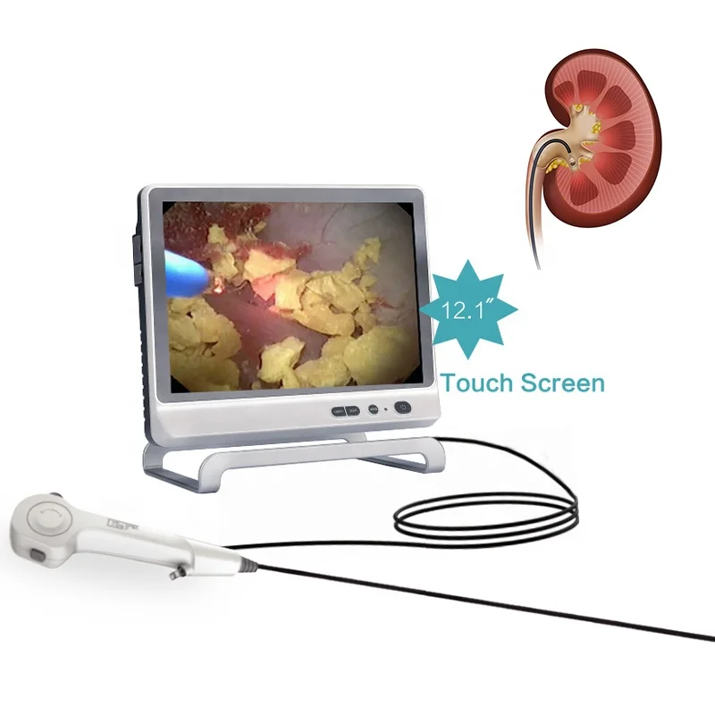 7.5fr 9.5fr Flexible Disposable Ureteroscope Single Use Urology Endoscope cystoscopy percutaneous nephroscopy